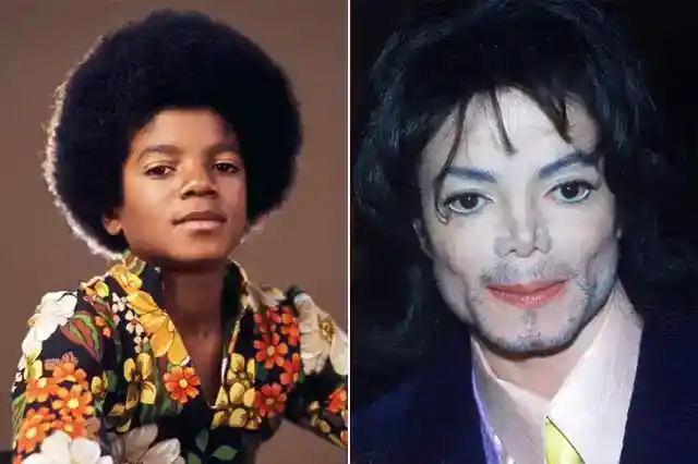 Michael Jackson – Prescription Drug Abuse