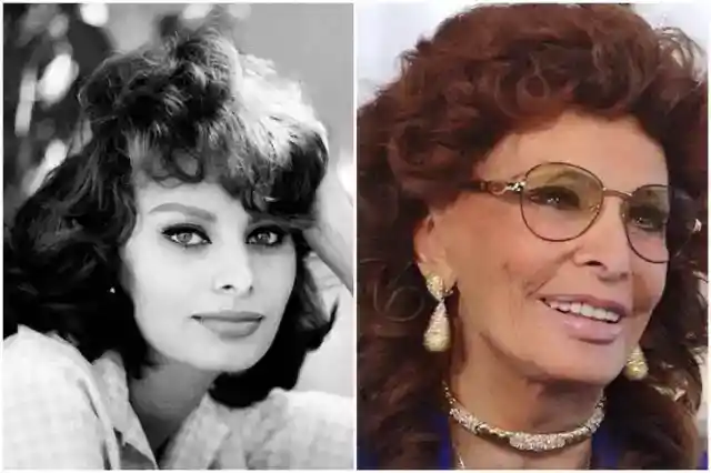 Sophia Loren – Nose and Lip Jobs