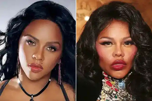 Lil’ Kim – Cosmetic Surgery