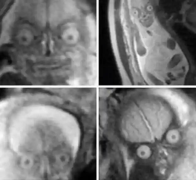 Una resonancia magnética que da miedo