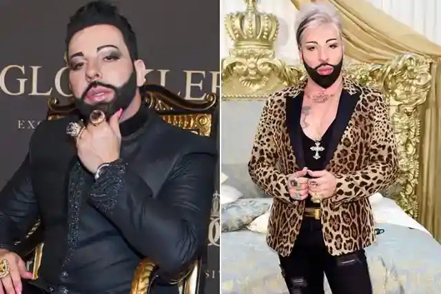 Harald Glööckler – 20 kilograms