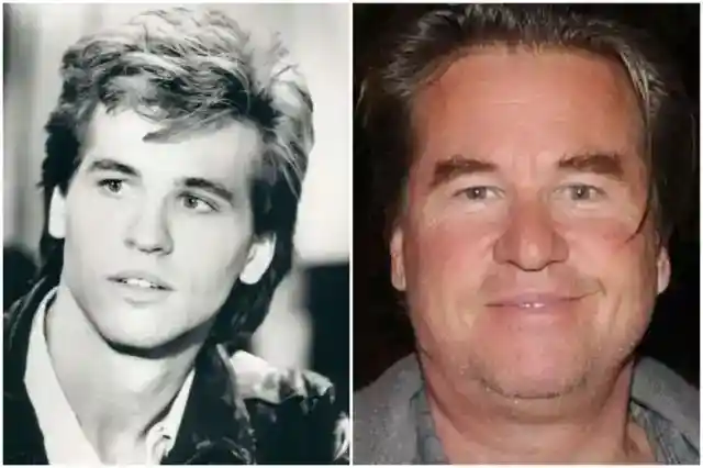 Val Kilmer – Throat Cancer Survivor