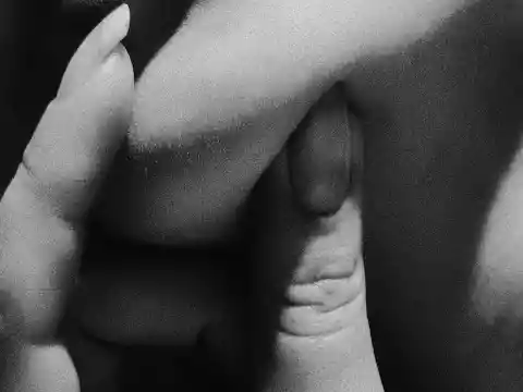 Removing Ingrown Hair 