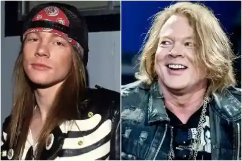 Axl Rose – Weight Gain