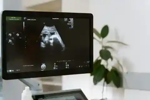 Ultrasonography