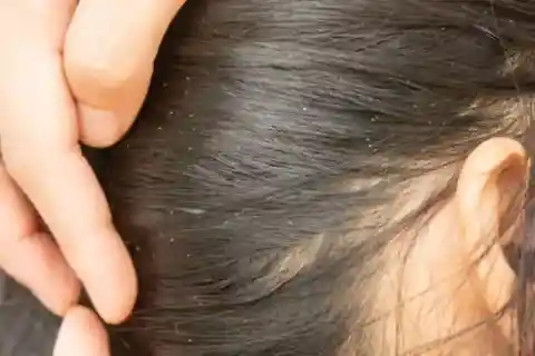 살아있는 머리