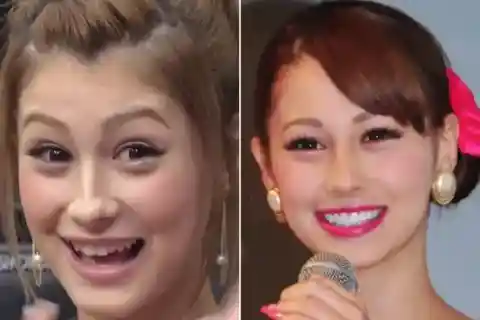 ダレノガレ 明美