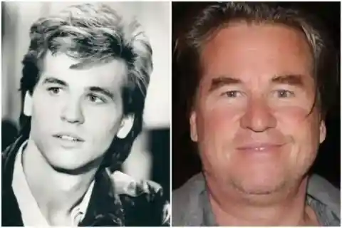 Val Kilmer – Throat Cancer Survivor