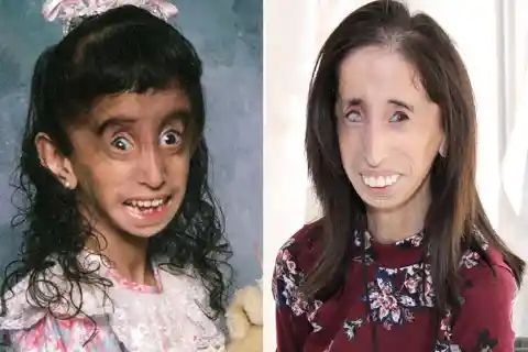 Lizzie Velásquez – Born in 1989